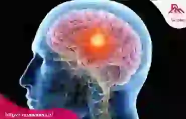بررسی علائم تشنج مغزی و عصبی چیست؟